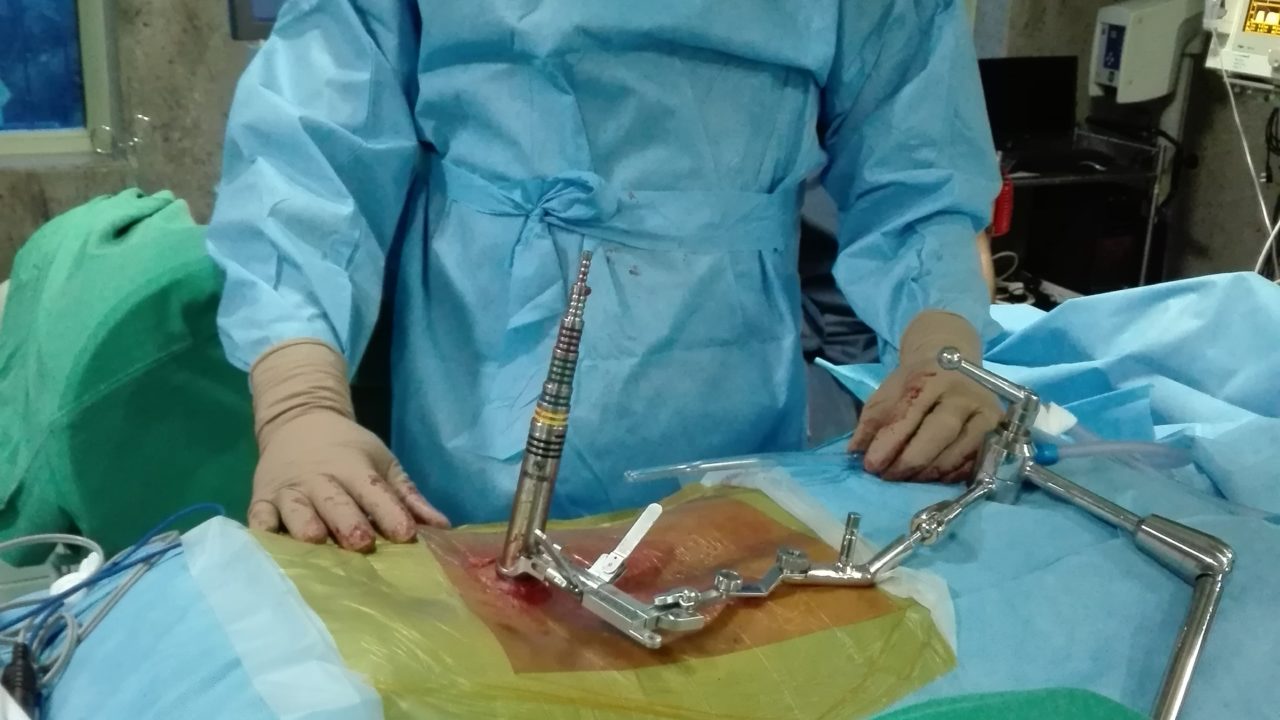 spine surgeon bangalore